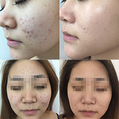 U・S様ビフォーアフター